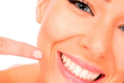 sonrisa perfecta